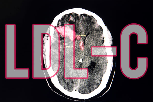 Triglycerides  ldl  hdl  cholesterol Low LDL Ldl cholesterol and Hemorrhagic Stroke | Medpage At present time – MedPage At present time